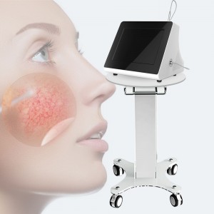 980 nm Diode Laser Spider Vein Removal