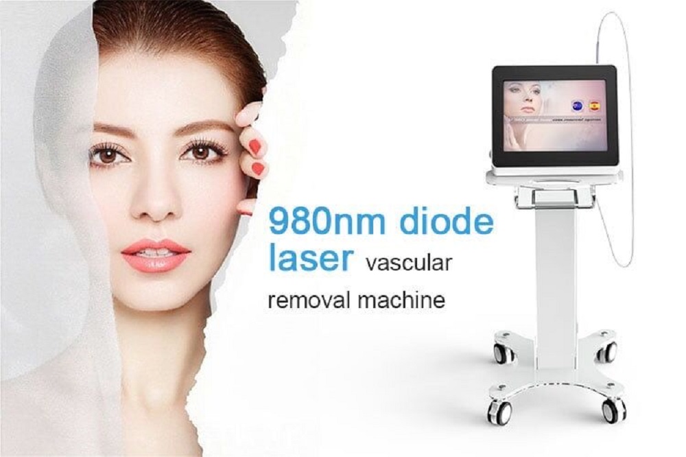 vascular spider vein removal diode laser 980 nm